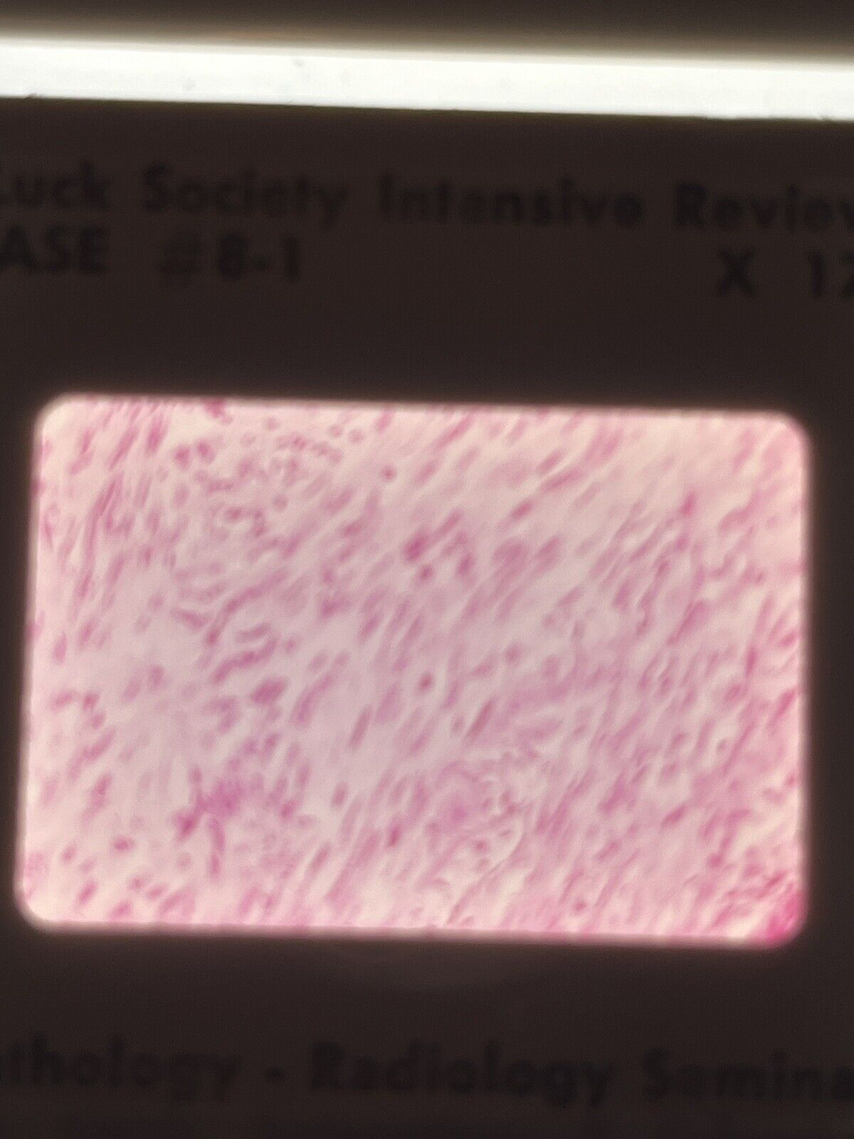5787785