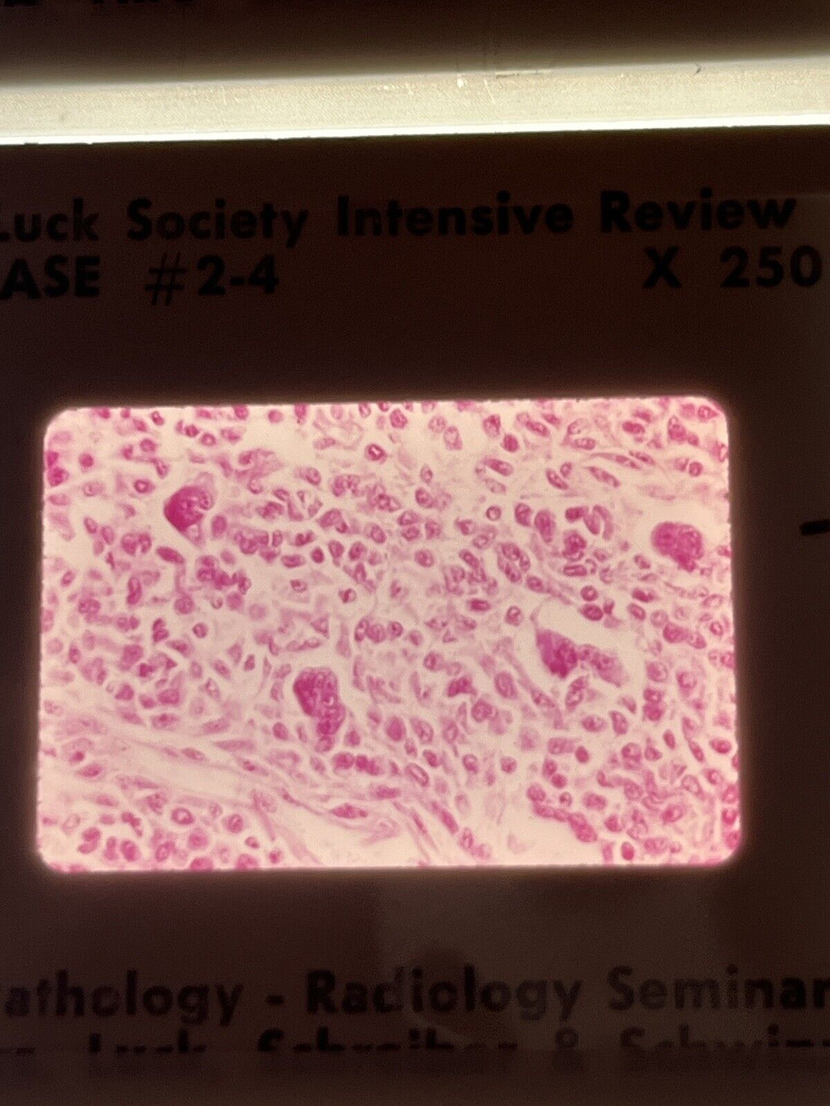 5276382